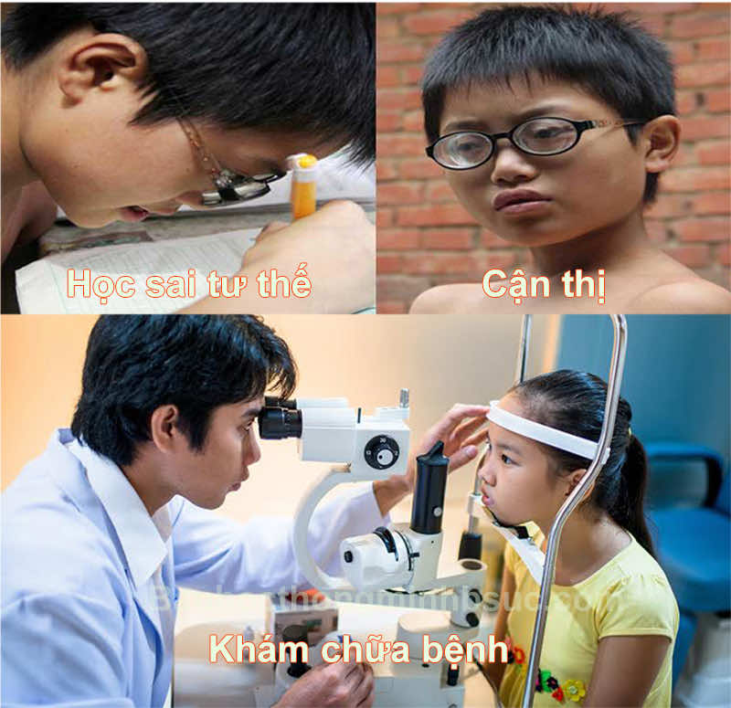 Tỷ lệ trẻ em bị cận thị tăng rất nhanh Tỷ lệ trẻ em bị cận thị tăng rất nhanh