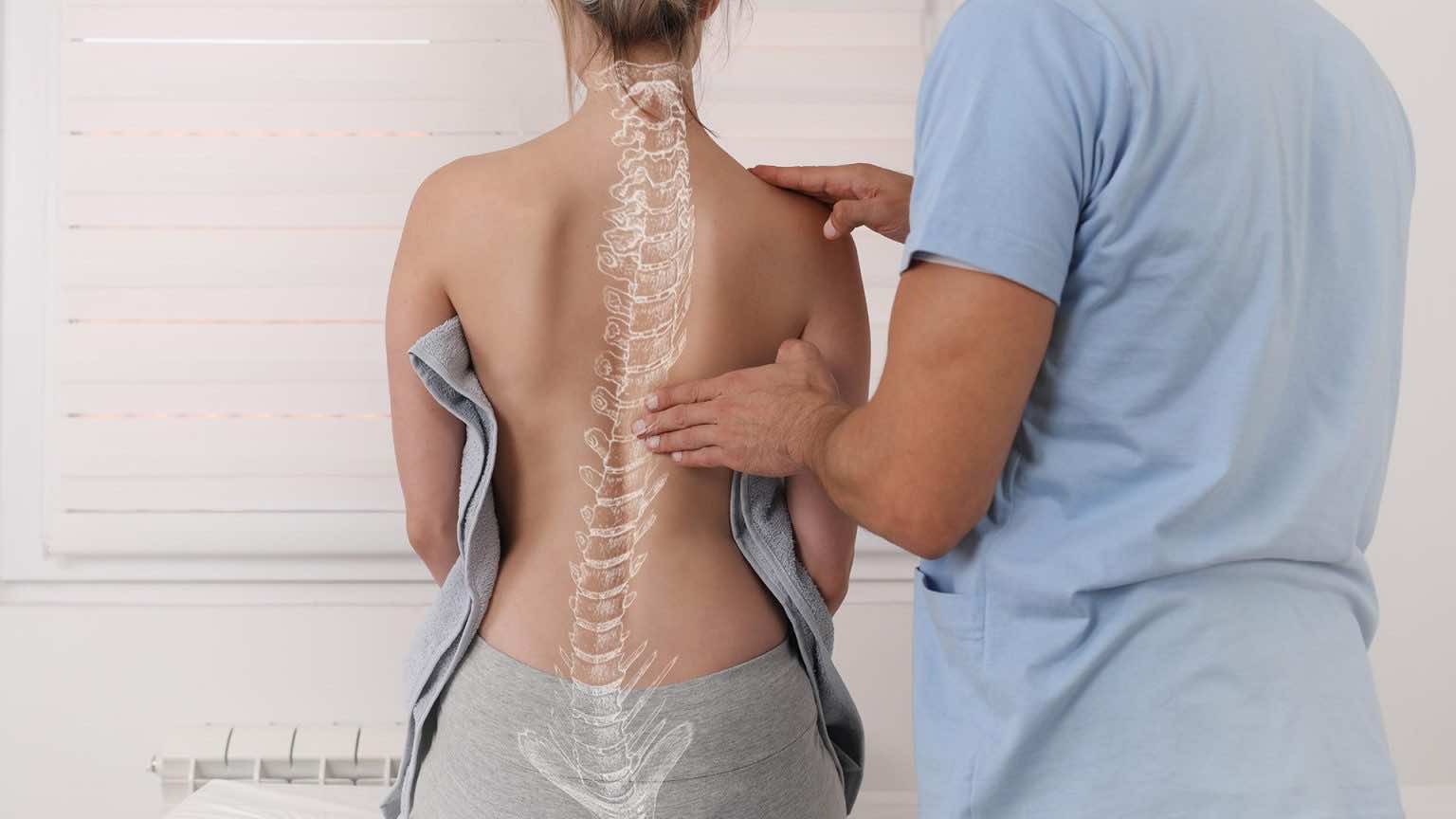 Gù lưng có chữa được không