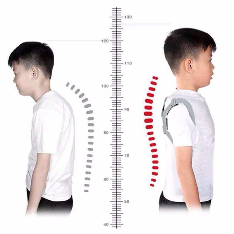 Nguyên nhân gây ra gù lưng ở trẻ em
