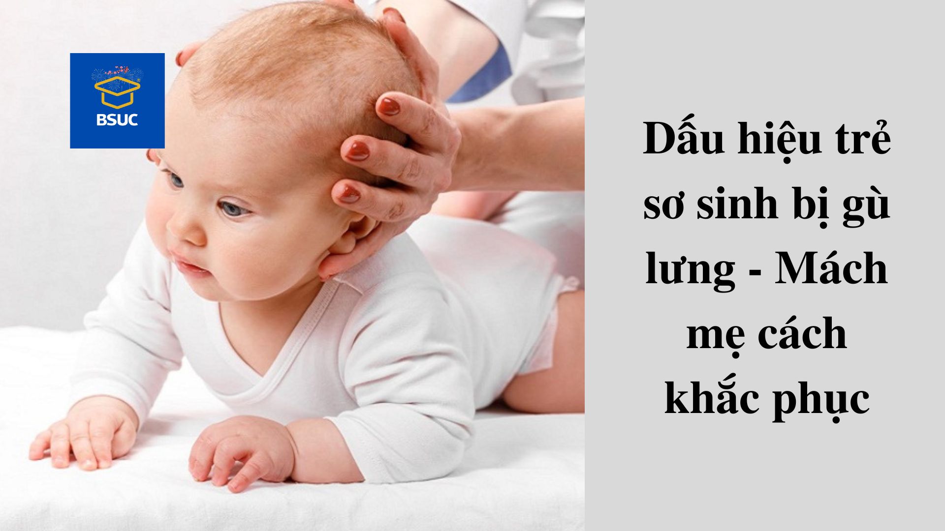 Dấu hiệu trẻ sơ sinh bị gù lưng – Mách mẹ cách khắc phục
