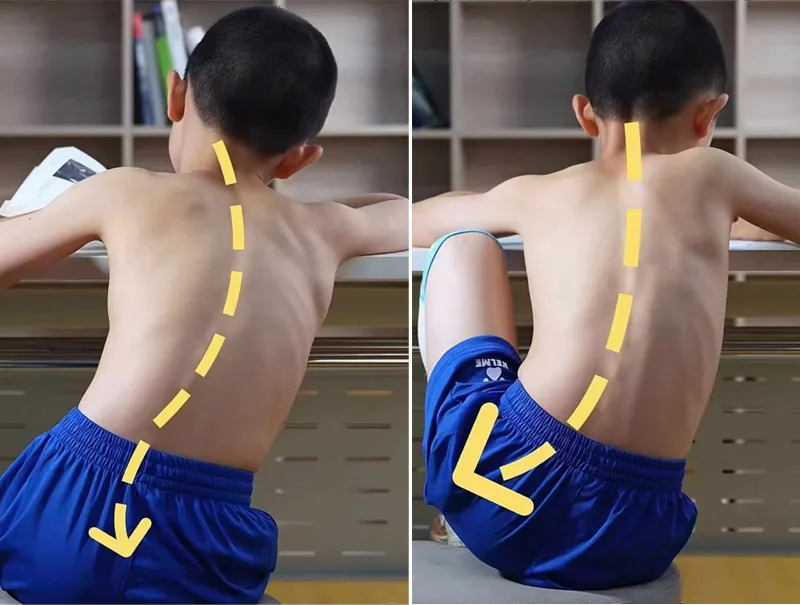 Ngồi học sai tư thế trẻ có nguy cơ bị gù lưng Ngồi học sai tư thế trẻ có nguy cơ bị gù lưng